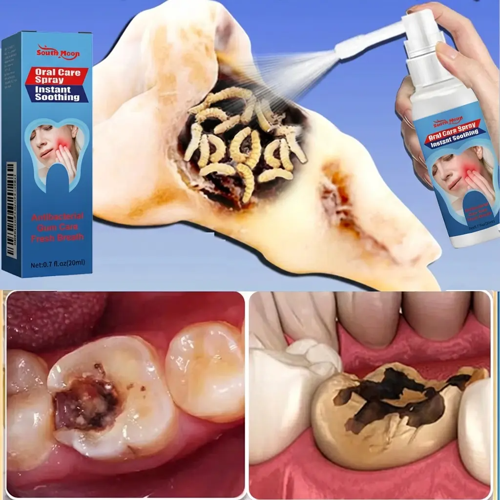 Nan Yue Oral Care Spray