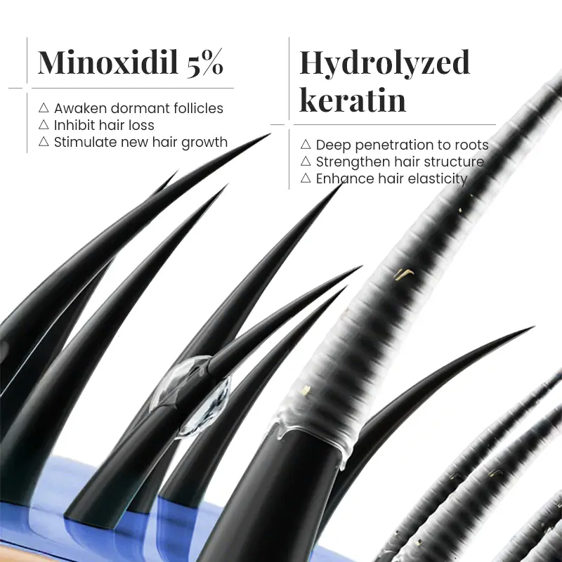 5% Minoxidil Scalp Cream with Keratin & Ginger